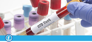 STD Screening Test Service Near Me in Fresno, CA STD Screening Test Service Near Me in Fresno, CA