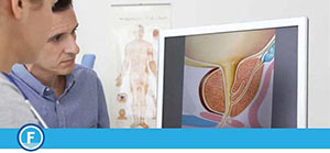 Prostate Screening Service Near Me in Fresno, CA Prostate Screening Service Near Me in Fresno, CA
