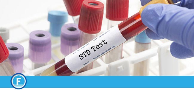 STD Screening Test Service Near Me in Fresno, CA STD Screening Test Service Near Me in Fresno, CA