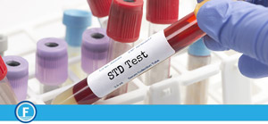 Questions to Ask About STD Testing Near Me in Fresno, CA