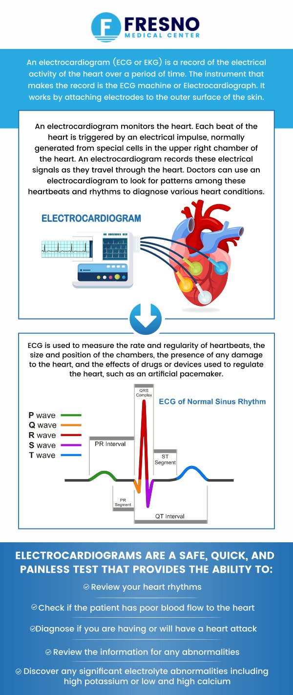An electrocardiogram (EKG) is a simple, painless, and quick test that records the electrical activity of your heart. An EKG test is an effective way to get information to help you diagnose a heart problem. If you are suffering from symptoms like chest pain, dizziness, shortness of breath, or weakness, visit Fresno Medical Center today. Our experienced doctors, Dr. Gurmej Dhillon, MD, and his team of medical professionals can have you get an EKG test done to check if your heart is working as well as it should! For more information, contact us now or schedule an appointment online. We are conveniently located at 6069 N First St # 103, Fresno, CA 93710. An electrocardiogram (EKG) is a simple, painless, and quick test that records the electrical activity of your heart. An EKG test is an effective way to get information to help you diagnose a heart problem. If you are suffering from symptoms like chest pain, dizziness, shortness of breath, or weakness, visit Fresno Medical Center today. Our experienced doctors, Dr. Gurmej Dhillon, MD, and his team of medical professionals can have you get an EKG test done to check if your heart is working as well as it should! For more information, contact us now or schedule an appointment online. We are conveniently located at 6069 N First St # 103, Fresno, CA 93710.