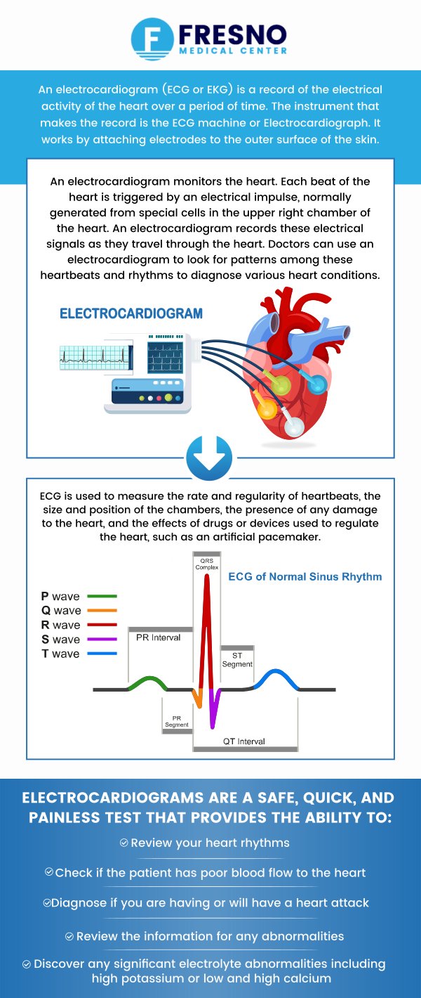 An electrocardiogram (EKG) is a simple, painless, and quick test that records the electrical activity of your heart. An EKG test is an effective way to get information to help you diagnose a heart problem. If you are suffering from symptoms like chest pain, dizziness, shortness of breath, or weakness, visit Fresno Medical Center today. Our experienced doctors, Dr. Gurmej Dhillon, MD, and his team of medical professionals can have you get an EKG test done to check if your heart is working as well as it should! For more information, contact us now or schedule an appointment online. We are conveniently located at 6069 N First St # 103, Fresno, CA 93710.